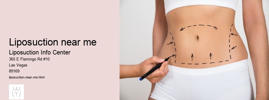 liposuction near me