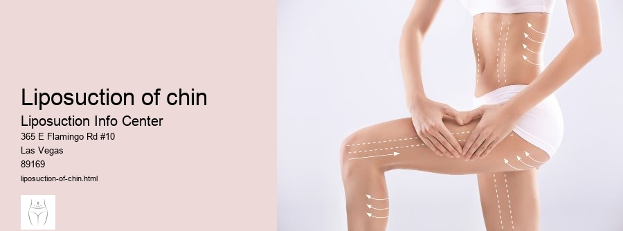 liposuction of chin