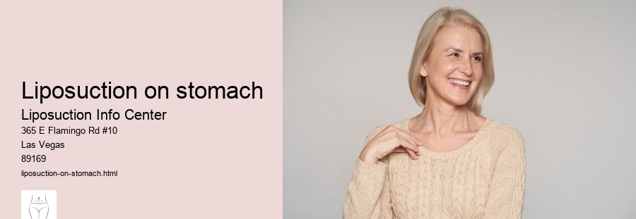 liposuction on stomach