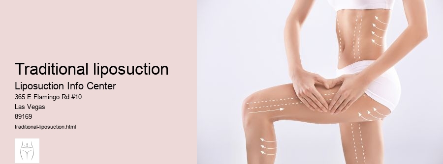 traditional liposuction